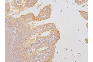 IHC analysis of SLC12A5 using anti-SLC12A5 antibody (ABIN6719415).
