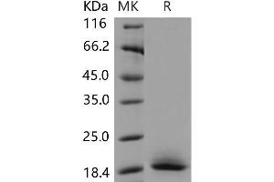 Western Blotting (WB) image for CD59a (CD59A) protein (His tag) (ABIN7320173) (CD59a Protein (CD59A) (His tag))