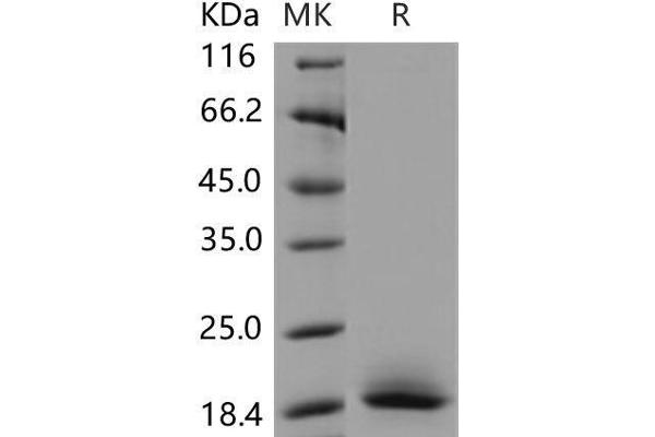 CD59a Protein (CD59A) (His tag)