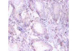 Immunohistochemistry of paraffin-embedded human prostate tissue using ABIN7173377 at dilution of 1:50 (HADHB Antikörper  (AA 35-283))