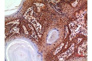 Immunohistochemistry (IHC) analysis of paraffin-embedded Human Skin, antibody was diluted at 1:100. (alpha 2 Macroglobulin Antikörper  (Internal Region))