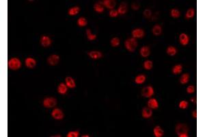 Immunofluorescence (fixed cells) (IF/ICC) image for anti-Vacuolar Protein Sorting 72 Homolog (S. Cerevisiae) (VPS72) (Internal Region) antibody (ABIN6266000)