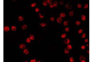 ABIN6266828 staining RAW264. (VPS72 Antikörper  (Internal Region))