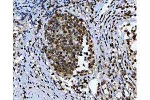IHC analysis of TRIR using anti-TRIR antibody (ABIN7603244). (Uncharacterized Protein C19orf43 (TRIR) (N-Term) Antikörper)
