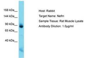 Image no. 1 for anti-Neurofilament Triplet M Protein (NEFM) (C-Term) antibody (ABIN6750526) (NEFM Antikörper  (C-Term))