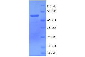 Tubulin, Beta, 3 (TUBB3) (AA 1-210), (partial) protein (GST tag) (TUBB3 Protein (AA 1-210, partial) (GST tag))