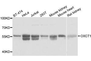 Western blot analysis of extracts of various cell lines, using OXCT1 antibody.