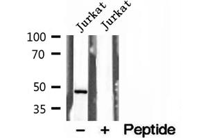 Western blot analysis of extracts of Jurkat cells, using Annexin VII antibody. (Annexin VII Antikörper  (N-Term))