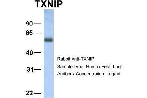 Host: Rabbit Target Name: TXNIP Sample Type: Human Fetal Lung Antibody Dilution: 1.