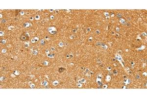 Immunohistochemistry of paraffin-embedded Human brain using PYGL Polyclonal Antibody at dilution of 1:35 (PYGL Antikörper)