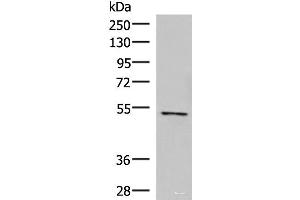 Western blot analysis of Jurkat cell lysate using POLD2 Polyclonal Antibody at dilution of 1:800