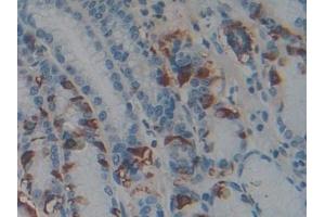 Immunohistochemistry (IHC) image for anti-Adenylate Cyclase Activating Polypeptide 1 (Pituitary) (ADCYAP1) (AA 17-176) antibody (ABIN7433510)
