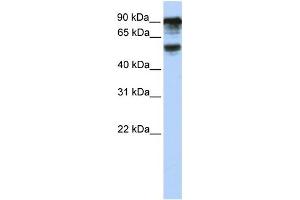WB Suggested Anti-TBC1D10B Antibody Titration: 0. (TBC1D10B Antikörper  (C-Term))