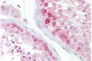 Immunohistochemistry (IHC) image for anti-Wingless-Type MMTV Integration Site Family, Member 2B (WNT2B) (N-Term) antibody (ABIN6748587)