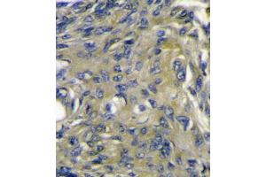 Immunohistochemistry (IHC) image for anti-C-Fos Induced Growth Factor (Vascular Endothelial Growth Factor D) (Figf) antibody (ABIN3002601) (VEGFD Antikörper)