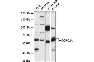 Western blot analysis of extracts of various cell lines, using CORO2A antibody (ABIN7266508) at 1:1000 dilution.