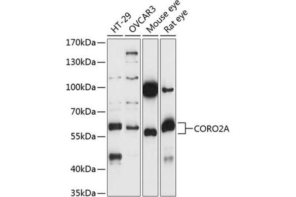 CORO2A Antikörper  (AA 376-525)