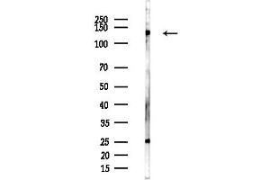 Western blot analysis of lysates from Hela cells(heat-shock,45 min treatment), using NMDAR1 Antibody at 1/1000 dilution.
