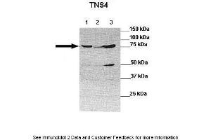 Lanes:  Lane 1: 30ug human 293T lysate Lane 2: 30ug human BEL7402 cell lysate Lane 3: 30ug human SMMC772 lysate  Primary Antibody Dilution:  1:1000 Secondary Antibody:  Anti-rabbit-HRP Anti-rabbit-HRP Secondary Antibody Dilution:  1:10,000 Gene Name:  TNS4 a Submitted by:  Dr Frankie Ko Chi Fat, Lo-Kong Chan, Irene O. (Tensin 4 Antikörper  (N-Term))
