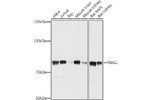 Western blot analysis of extracts of various cell lines, using PI antibody (ABIN6128448, ABIN6145592, ABIN6145594 and ABIN6214191) at 1:1000 dilution. (PIAS1 Antikörper  (AA 422-651))