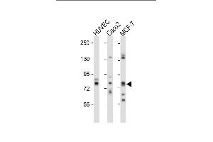 All lanes : Anti-cGKII Antibody (C-term) at 1:1000 dilution Lane 1: HUVEC whole cell lysate Lane 2: Caco2 whole cell lysate Lane 3: MCF-7 whole cell lysate Lysates/proteins at 20 μg per lane. (PRKG2 Antikörper  (C-Term))