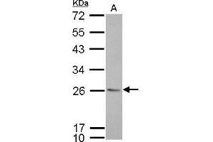WB Image CD74 antibody [N1N2], N-term detects CD74 protein by Western blot analysis.