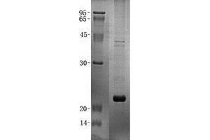 Validation with Western Blot (ZBP1 Protein (Transcript Variant 1) (His tag))