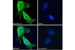 ABIN570923 Immunofluorescence analysis of paraformaldehyde fixed 3T3-L1 cells, permeabilized with 0.