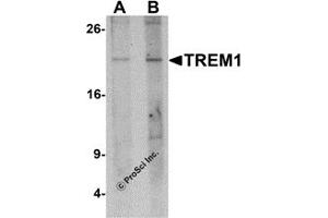Western Blotting (WB) image for anti-Triggering Receptor Expressed On Myeloid Cells 1 (TREM1) (N-Term) antibody (ABIN1077426) (TREM1 Antikörper  (N-Term))