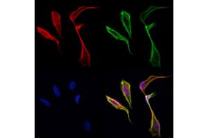 ABIN6257912 and ABIN6274177 staining Hela cells by IF/ICC. (PFKFB1 Antikörper  (C-Term))