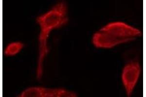 ABIN6279673 staining NIH-3T3 cells by IF/ICC. (PABPC3 Antikörper)