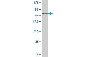 Western Blot detection against Immunogen (57. (DLX3 Antikörper  (AA 1-287))