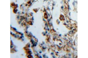 IHC-P analysis of lung tissue, with DAB staining. (FES Antikörper  (AA 510-770))
