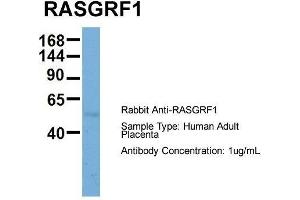 Host: Rabbit  Target Name: RASGRF1  Sample Tissue: Human Adult Placenta  Antibody Dilution: 1. (RASGRF1 Antikörper  (Middle Region))