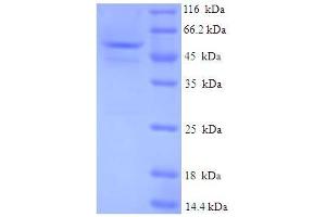 SDS-PAGE (SDS) image for Guanosine Monophosphate Reductase (GMPR) (AA 1-345), (full length) protein (His-SUMO Tag) (ABIN5710926) (GMPR Protein (AA 1-345, full length) (His-SUMO Tag))