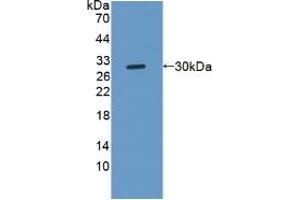 Detection of Recombinant NOTCH2NL, Human using Polyclonal Antibody to Notch2 N-Terminal Like Protein (NOTCH2NL) (NOTCH2NL Antikörper  (AA 1-236))