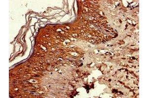 Immunohistochemistry of paraffin-embedded human skin tissue using ABIN7168111 at dilution of 1:100 (RNASEH2C Antikörper  (AA 1-164))