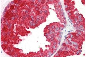 Image no. 2 for anti-Acid Phosphatase, Prostate (ACPP) (AA 269-282) antibody (ABIN1493860) (ACPP Antikörper  (AA 269-282))