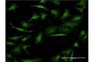 Immunofluorescence of monoclonal antibody to GIF on HeLa cell.