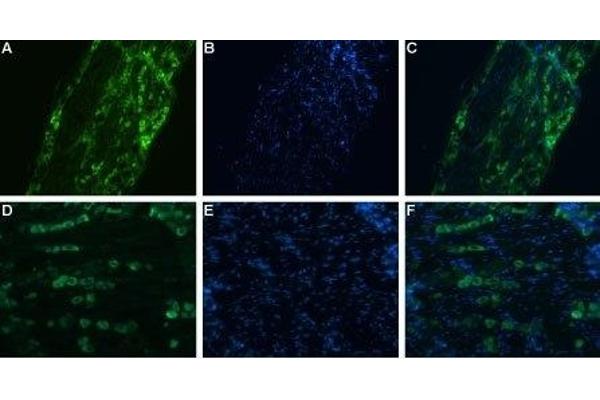 SCN11A Antikörper  (C-Term, Intracellular)