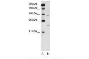 Image no. 2 for anti-Solute Carrier Family 36 (Proton/amino Acid Symporter), Member 3 (SLC36A3) (N-Term) antibody (ABIN205028) (SLC36A3 Antikörper  (N-Term))