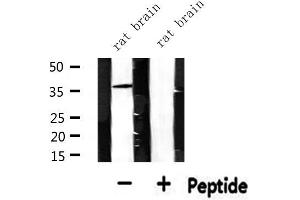 Western blot analysis of extracts from rat brain, using CDKL4 Antibody. (CDKL4 Antikörper  (Internal Region))