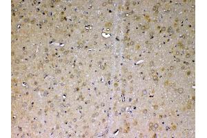 Immunohistochemistry (IHC) image for anti-Adenosine Deaminase (ADA) (AA 2-238) antibody (ABIN5692790)