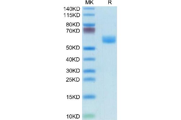 FAS Protein (AA 22-169) (Fc Tag)