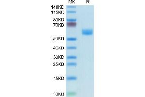 Mouse Fas/TNFRSF6/CD95 on Tris-Bis PAGE under reduced condition. (FAS Protein (AA 22-169) (Fc Tag))