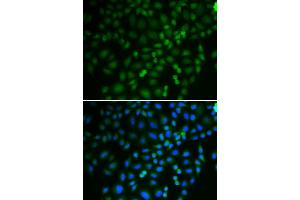 Immunofluorescence analysis of U2OS cells using TRIM21 antibody.