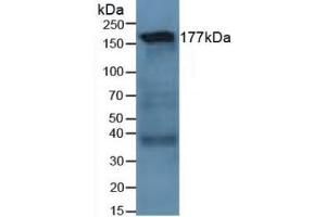 Detection of LAMC1 in Human Lung Tissue using Polyclonal Antibody to Laminin Gamma 1 (LAMC1) (Laminin gamma 1 Antikörper  (AA 521-772))