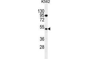 TdT Antibody (C-term) western blot analysis in K562 cell line lysates (35 µg/lane).