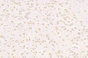 Immunohistochemistry analysis of paraffin-embedded mouse substantia nigra using VPS13B (ABIN7076176) at dilution of 1: 2000 (VPS13B Antikörper)