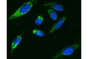 IF analysis of ATP5F1B using anti-ATP5F1B antibody (ABIN7599866). (Atp5f1b (AA 123-529) Antikörper)